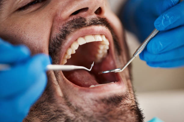 Best Holiday Emergency Dentist in North Cape May, NJ