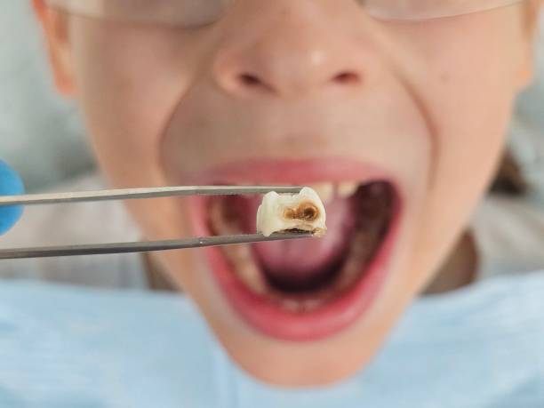 Best Pediatric Emergency Dentist in North Cape May, NJ
